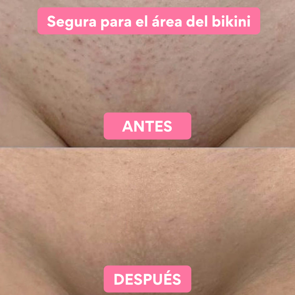 Cutisé® Depilador Exfoliante de Cristal